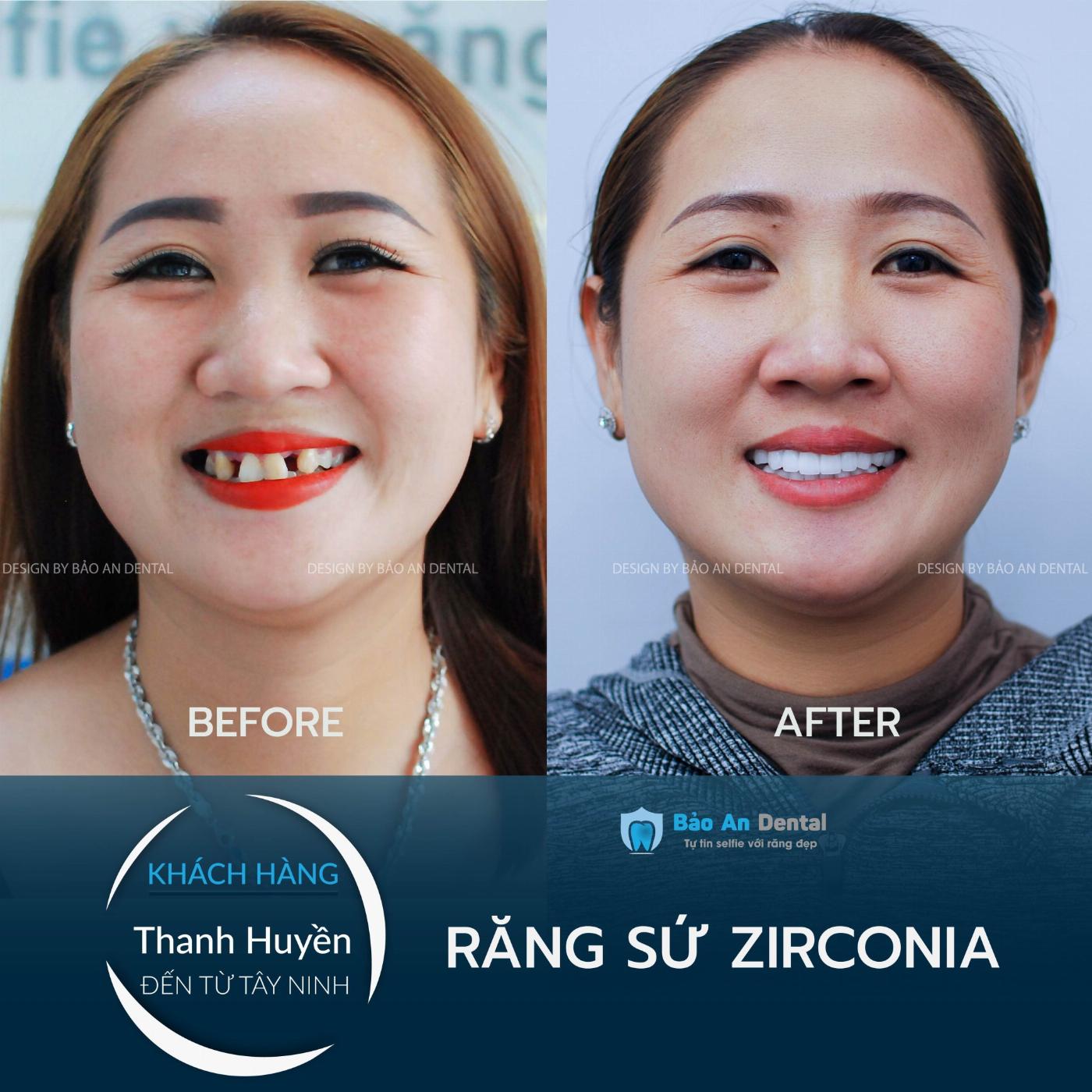 Review Phòng Khám Nha Khoa Gần Đây Uy Tín - Giá Rẻ - Chất Lượng