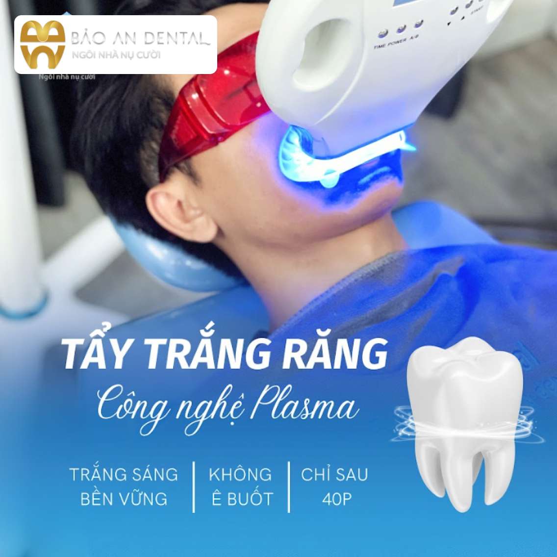 Giới thiệu công nghệ tẩy trắng răng bằng công nghệ Plasma