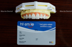 Răng Sứ HT Smile đang là lựa chọn hoàn hảo cho các khuyết điểm về răng.