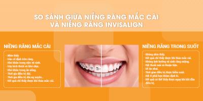So sánh niềng răng mắc cài và niềng răng trong suốt invisalign