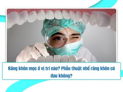 Răng khôn mọc ở vị trí nào? Phẫu thuật nhổ răng khôn có đau không?